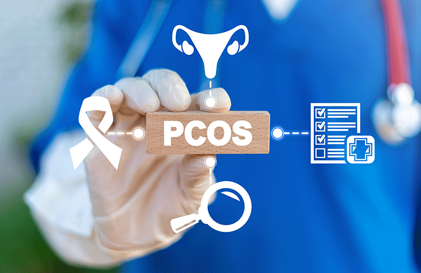 PCOS: 20 anni dopo